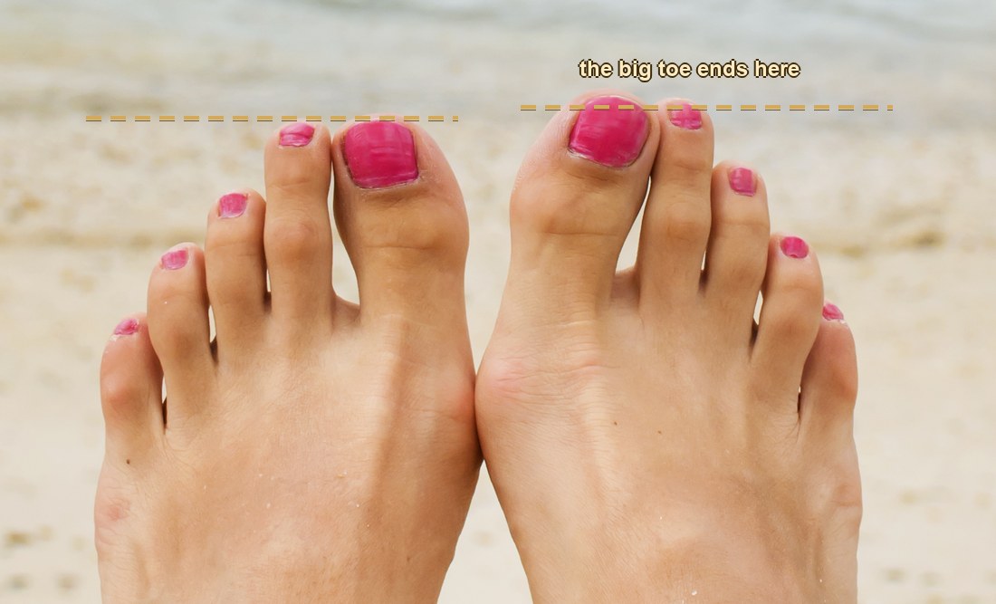Two feet with lines marking the ends of the big toes for a visual comparison