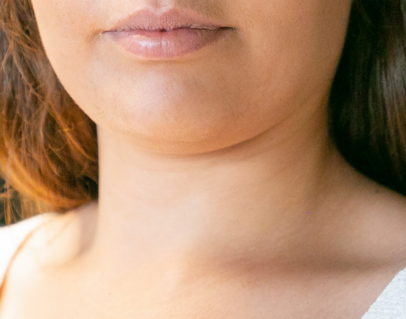 Close-up of a full, rounded chin and lower face