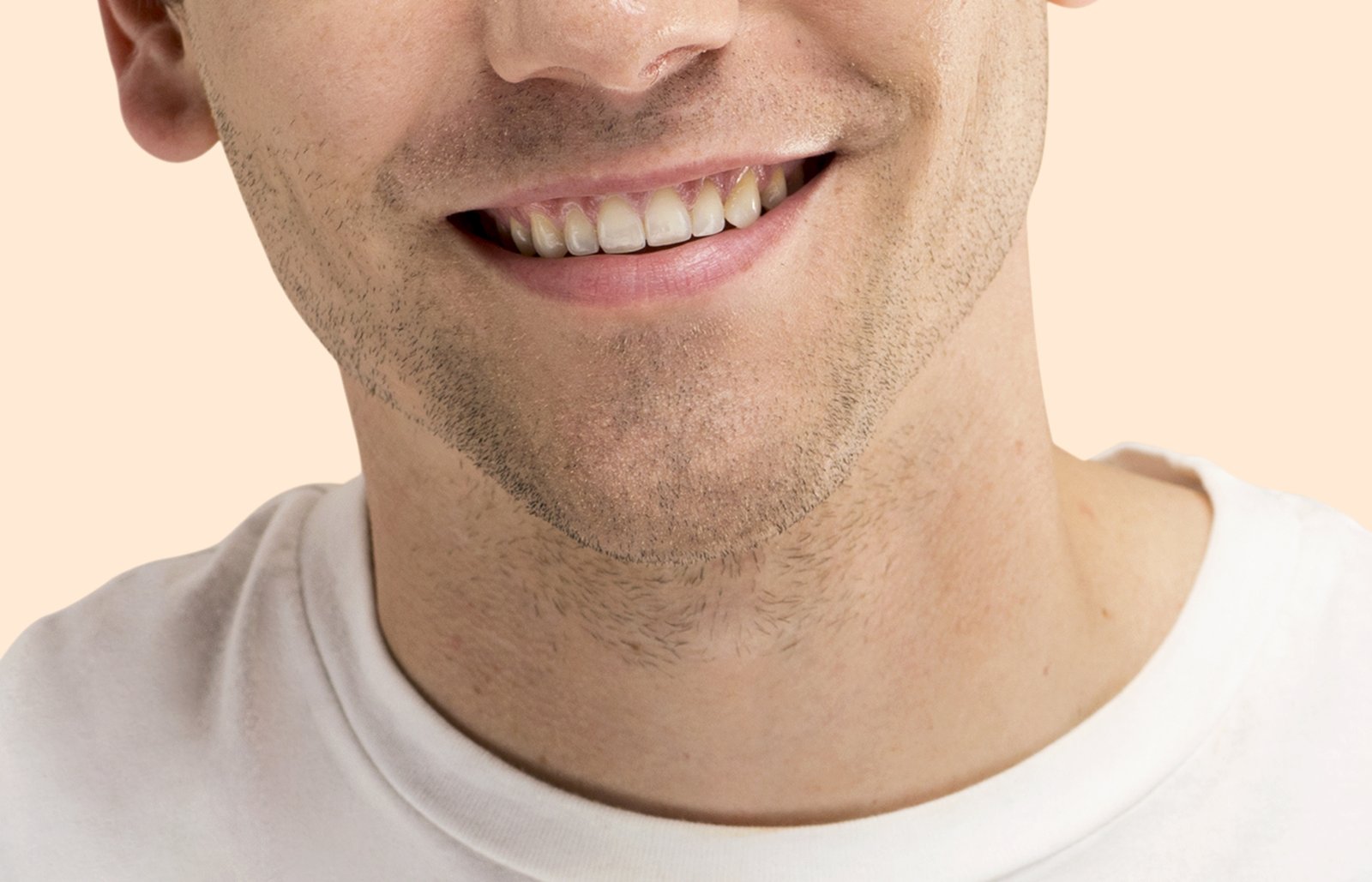 Close-up of a wide, angular jaw and chin below the nose