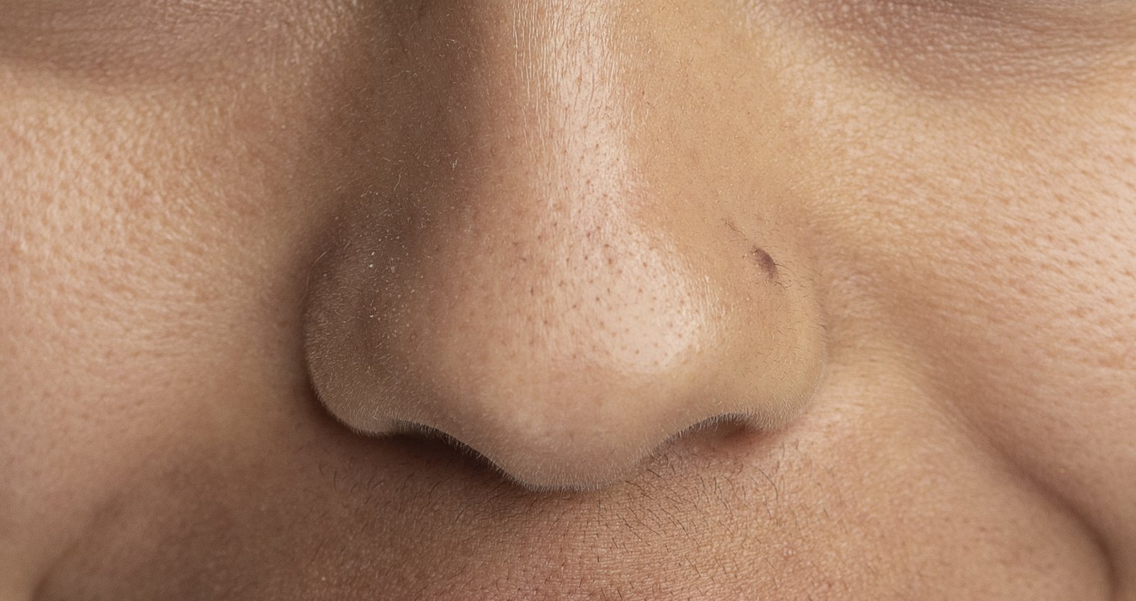 Close-up of the tip of the nose and the sides of the nostrils, the spleen and stomach zone