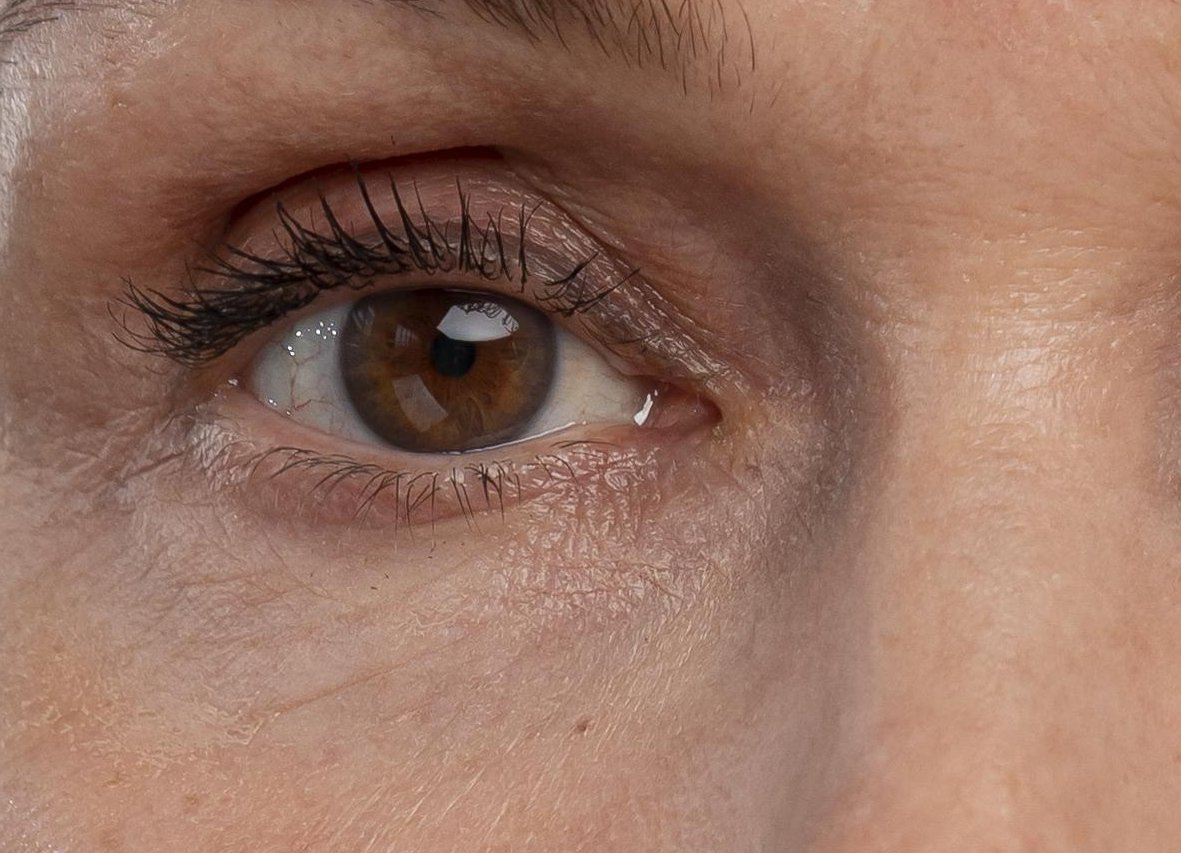 Close-up of one eye and the under-eye skin, part of the kidney zone on the face map