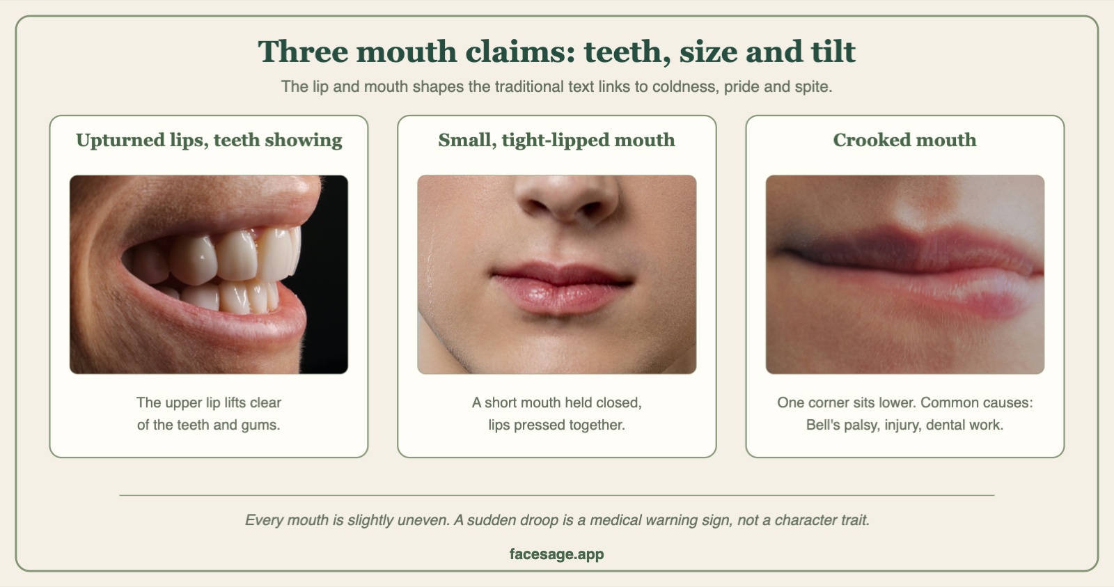 Three close-up mouth photos: an upper lip lifted off the teeth, a small closed mouth, and a mouth with one corner lower than the other