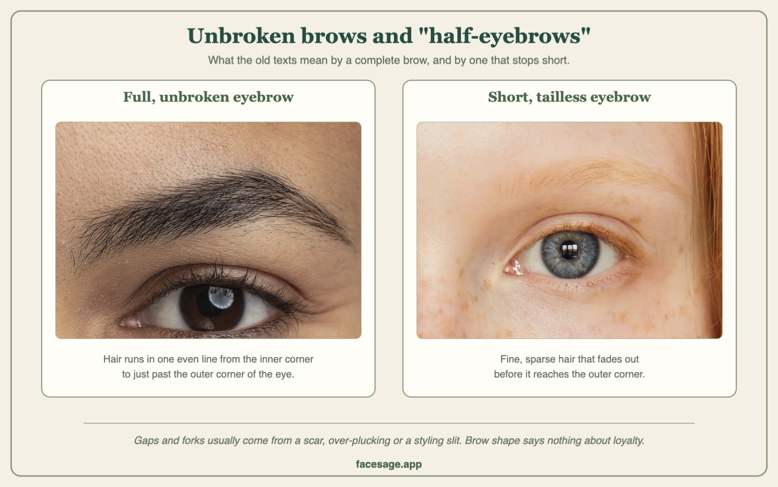 Two close-up photos of one eye and brow each, comparing a full unbroken eyebrow with a short, sparse eyebrow that fades before the outer corner