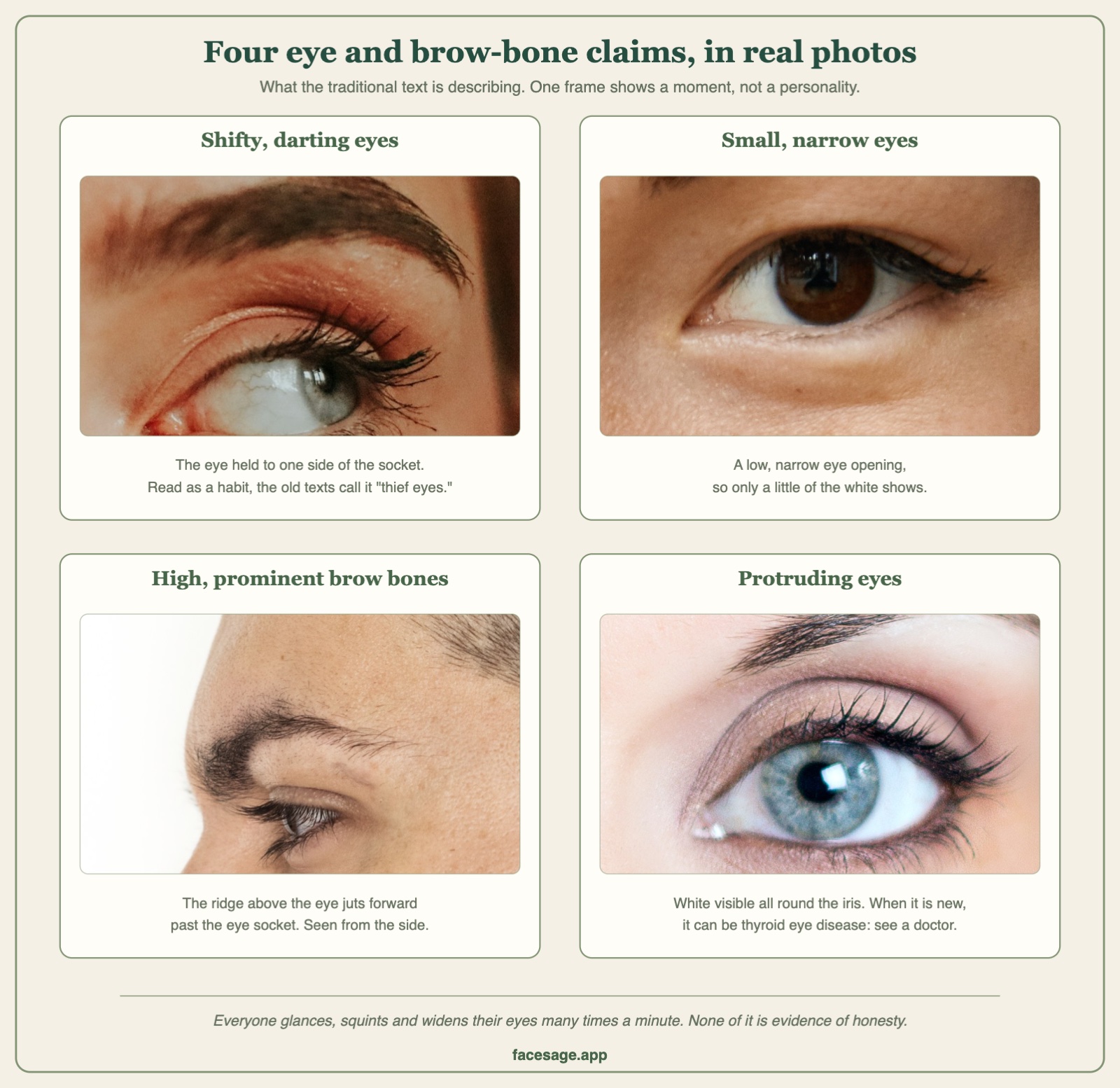Four close-up eye photos: an eye glancing sideways, a narrow eye, a brow ridge in profile, and a wide eye with white showing around the iris