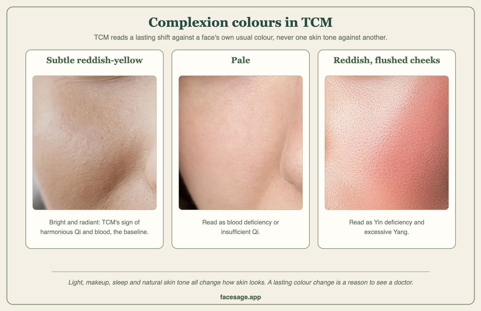 Three close-ups of cheek skin labelled subtle reddish-yellow, pale, and reddish flushed cheeks