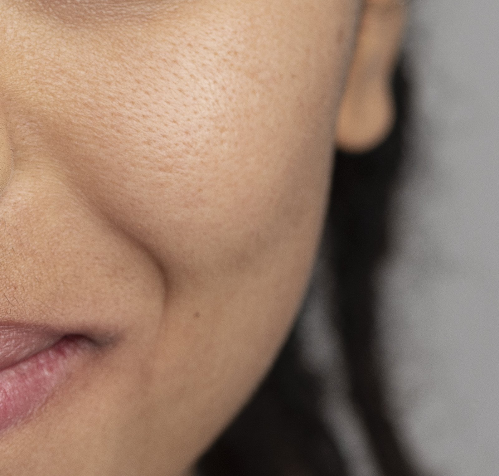 Close-up of cheek skin showing pores and texture