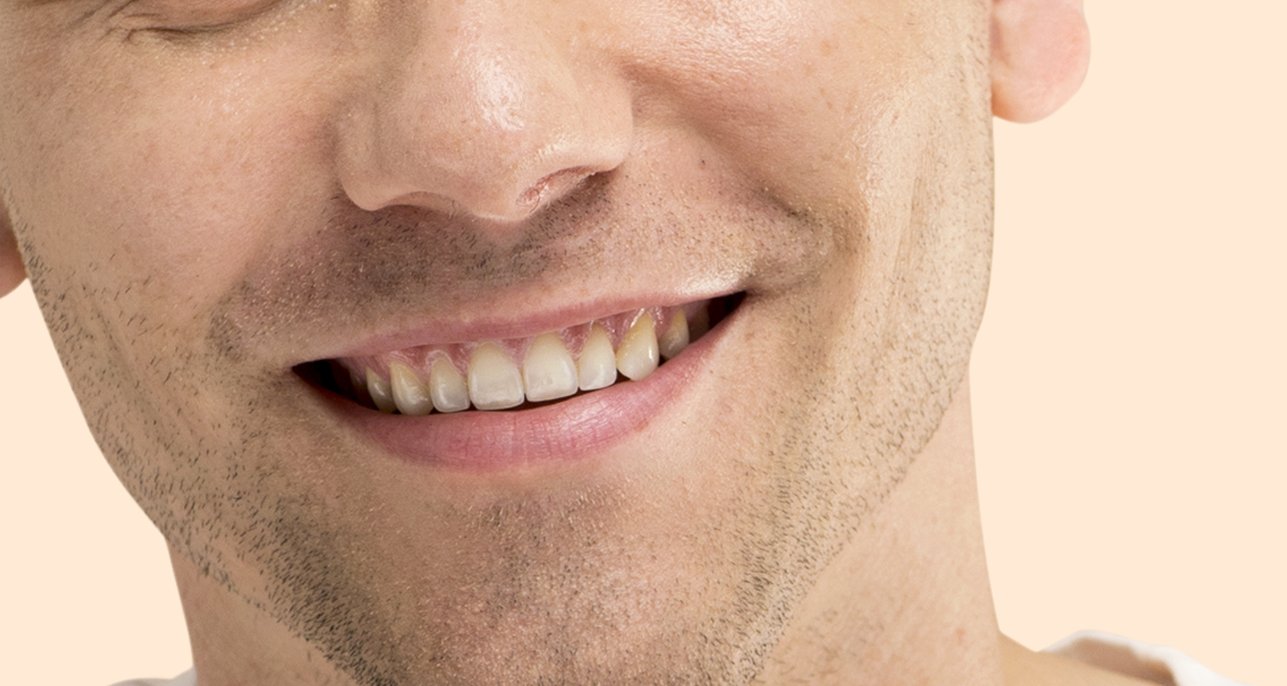 Close-up of an even, symmetrical smile