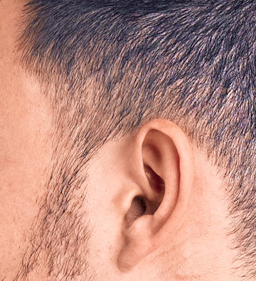Side close-up of a man's ear showing the ear opening