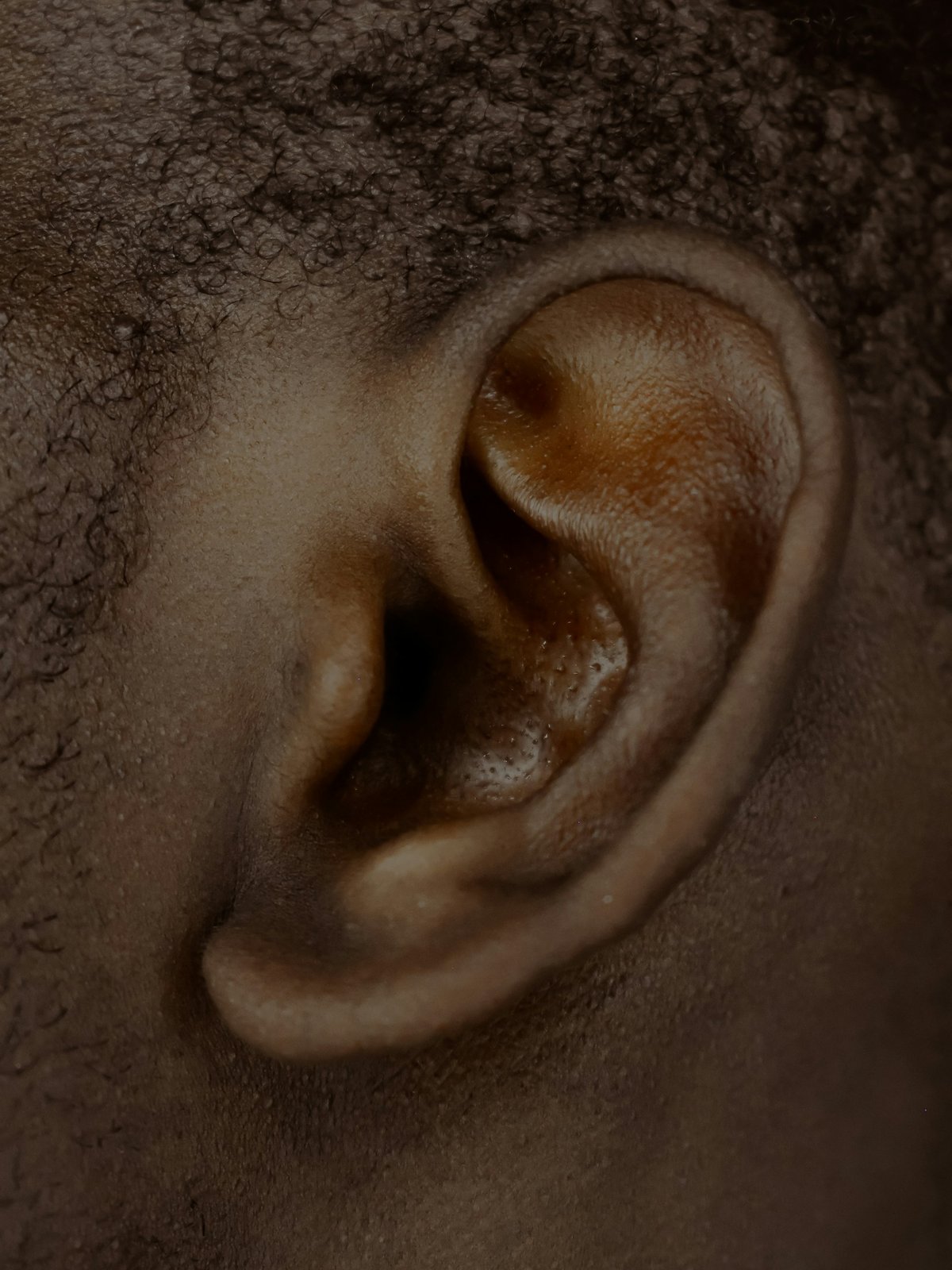 Close-up of an ear with a sharply defined, prominent rim
