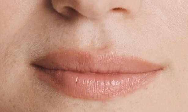 Close-up of a clearly defined philtrum above the lips