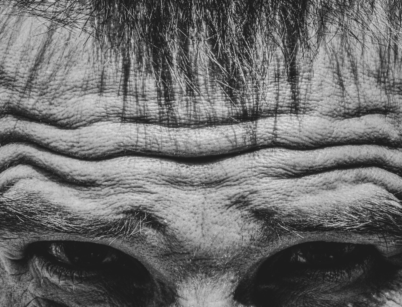 Close-up of a forehead with several parallel horizontal wrinkles