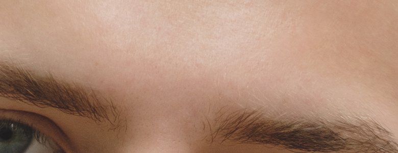 Close-up of the smooth area between the eyebrows