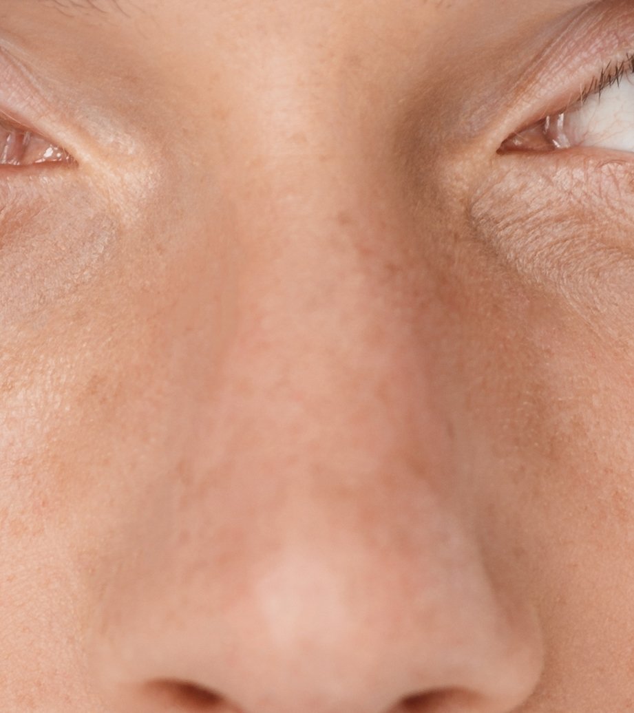 Close-up of the root and straight bridge of a nose