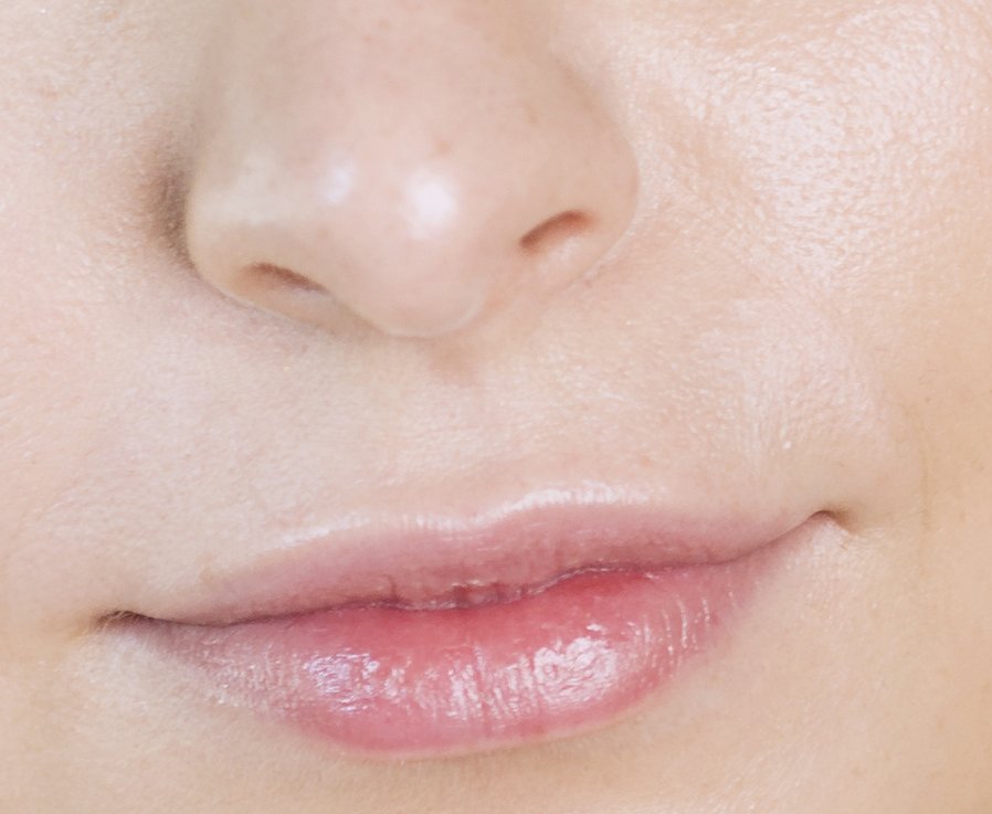 Close-up of the philtrum between the nose tip and the upper lip