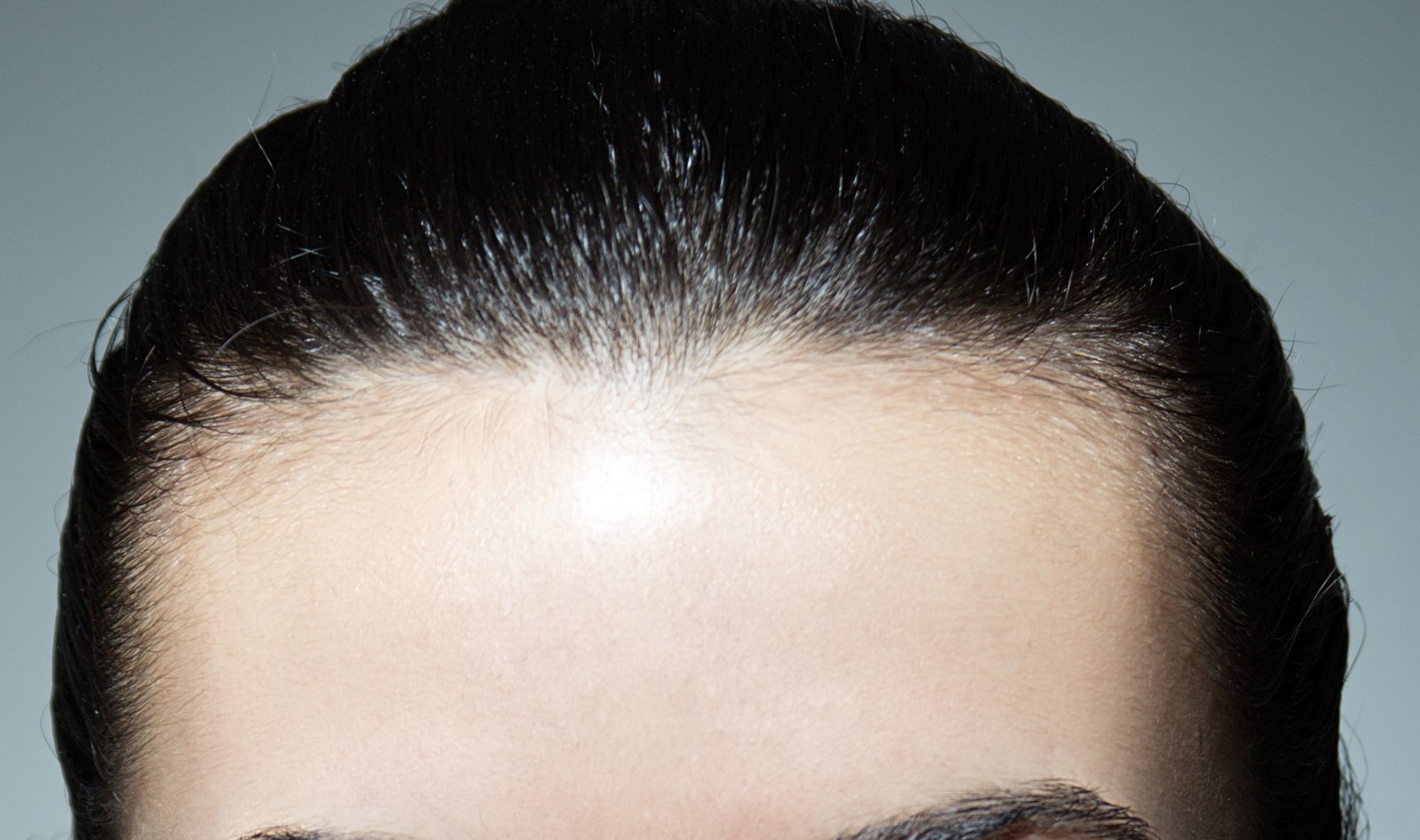 Close-up of a full, smooth forehead