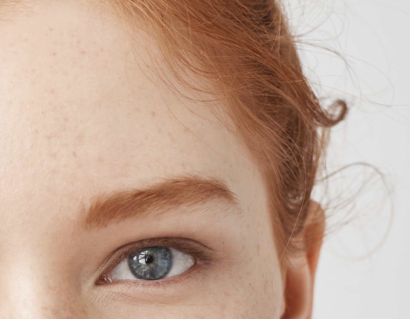Close-up of the area from the outer corner of the eye to the hairline