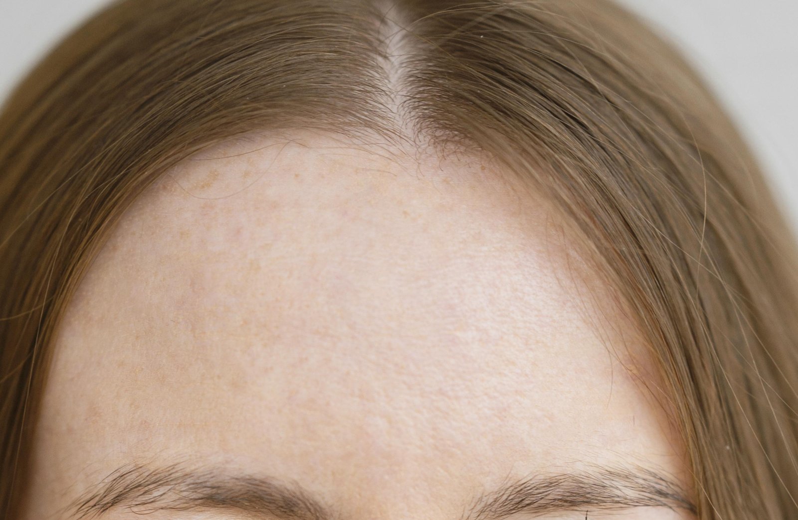 Close-up of a broad, smooth forehead between the hairline and the eyebrows