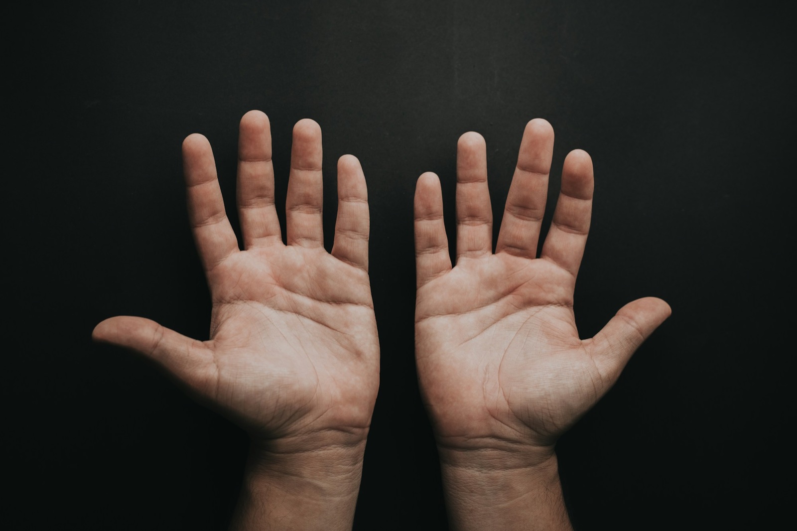Two open palms side by side showing their lines