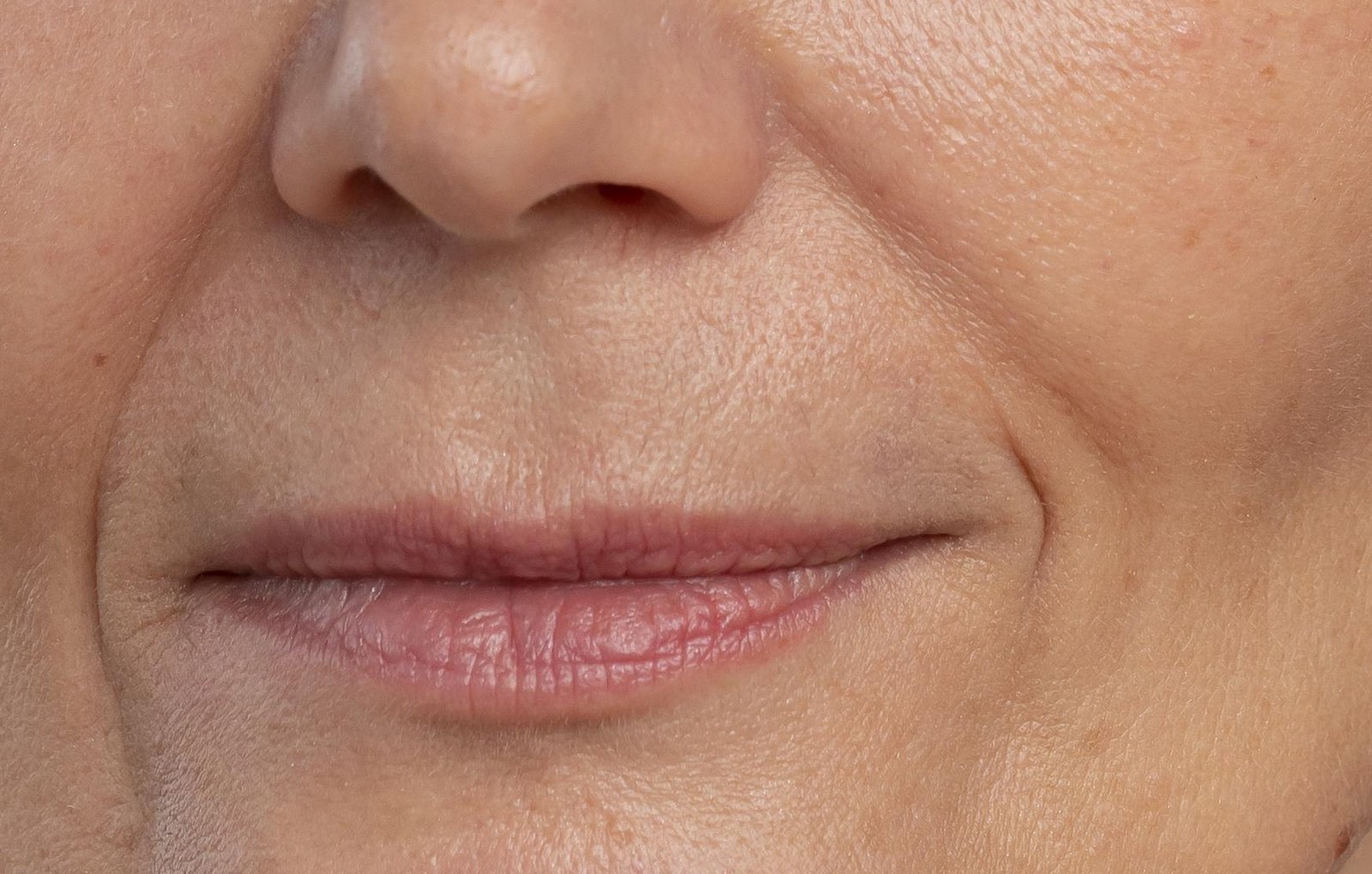 Close-up of the philtrum, the groove between the nose and upper lip