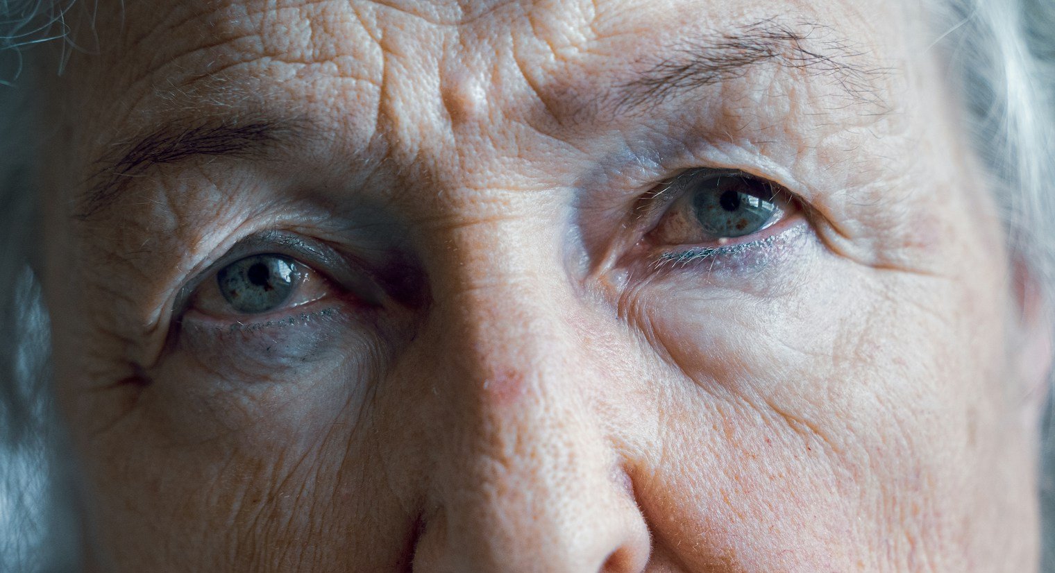 Older woman's brows and forehead, with an open space between the brows