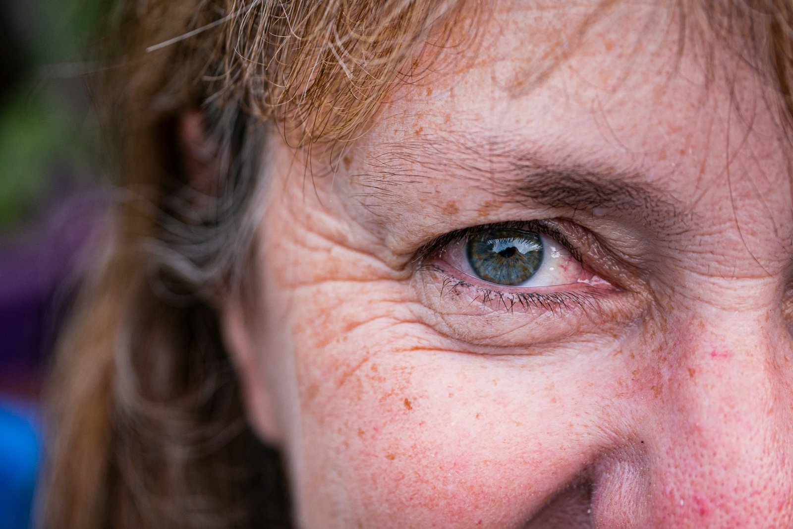 Close-up of an eye with fine wrinkles beneath it