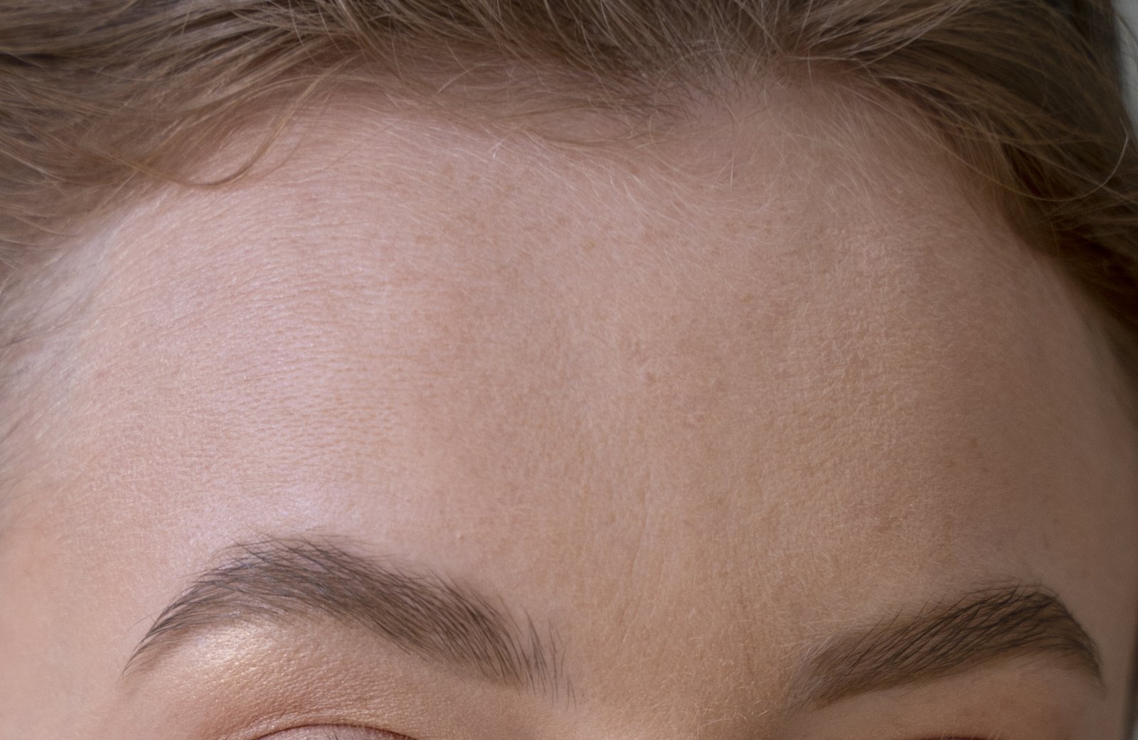 Front close-up of a forehead and eyebrows
