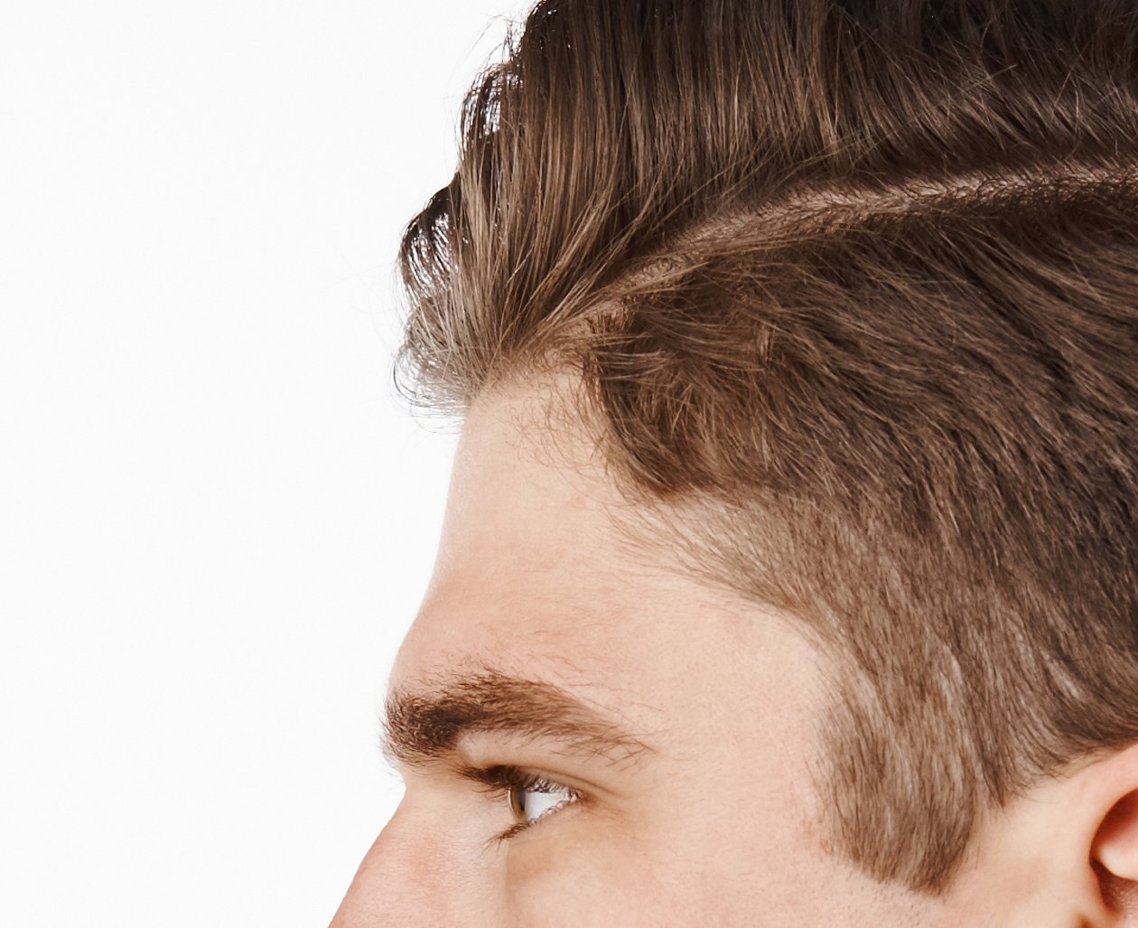 Side view of a short forehead with the hairline close to the brow