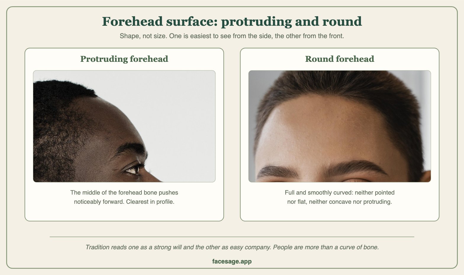 Two real forehead close-ups comparing a protruding forehead in profile and a round forehead from the front