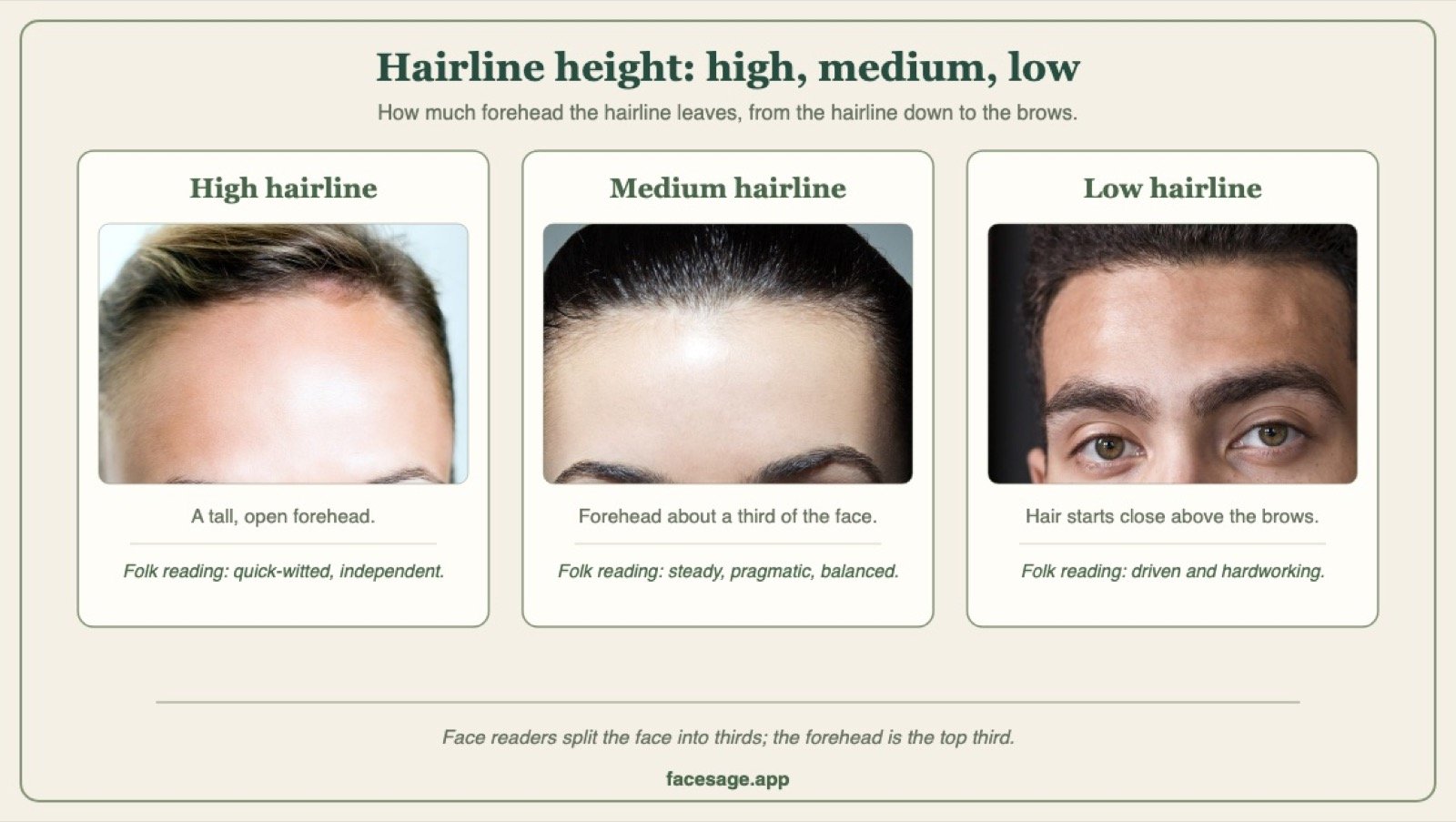 Three real forehead close-ups comparing a high, a medium and a low hairline