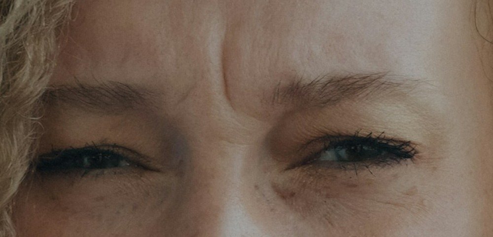 Close-up of furrowed brows showing a vertical line between the eyebrows