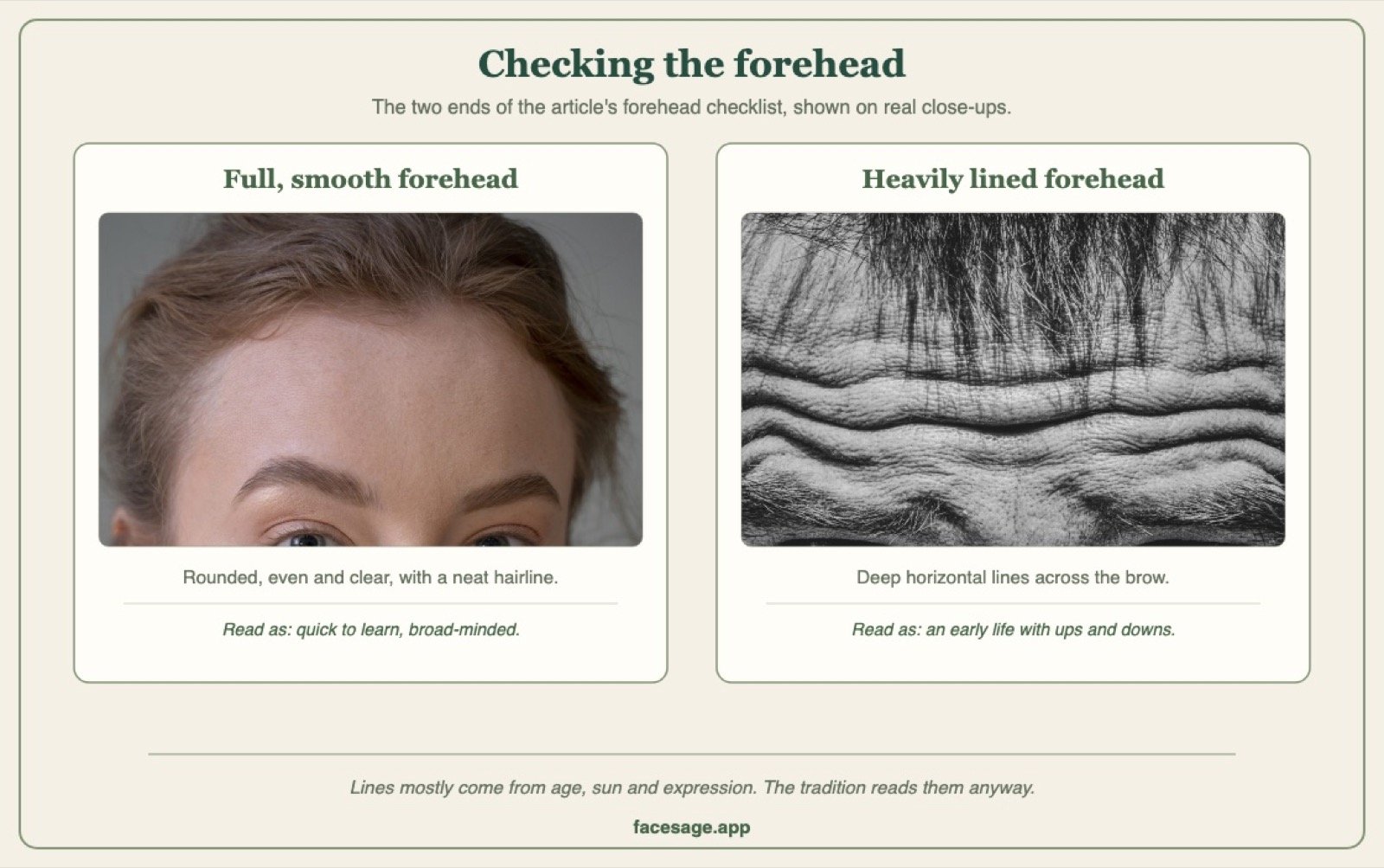 Two forehead close-ups: one full and smooth, one with deep horizontal lines