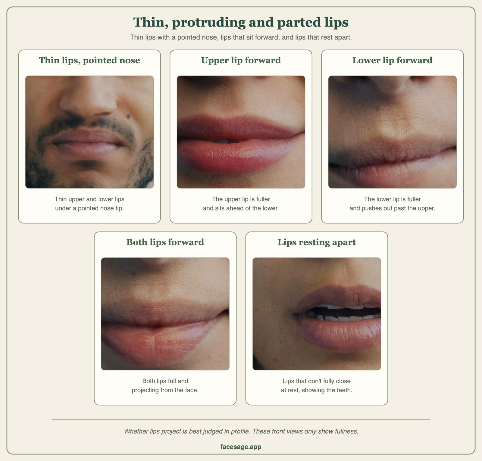 Five real mouth close-ups: thin lips, a fuller upper lip, a fuller lower lip, both lips full, and lips resting apart