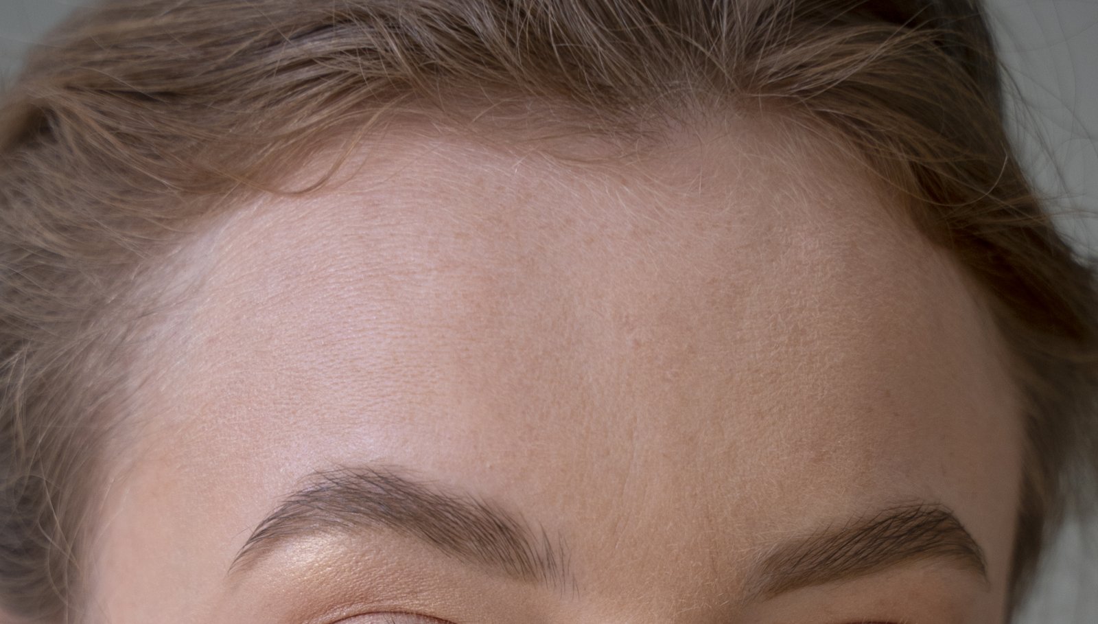Close-up of a full, smooth forehead with a neat hairline
