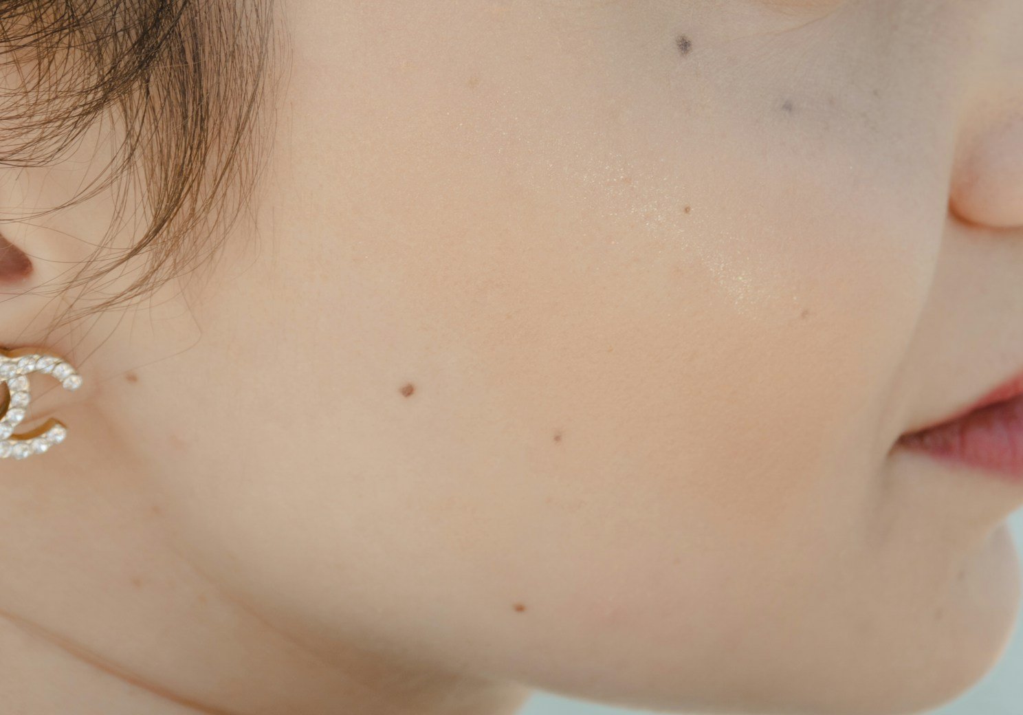 A cheek near the ear with small moles