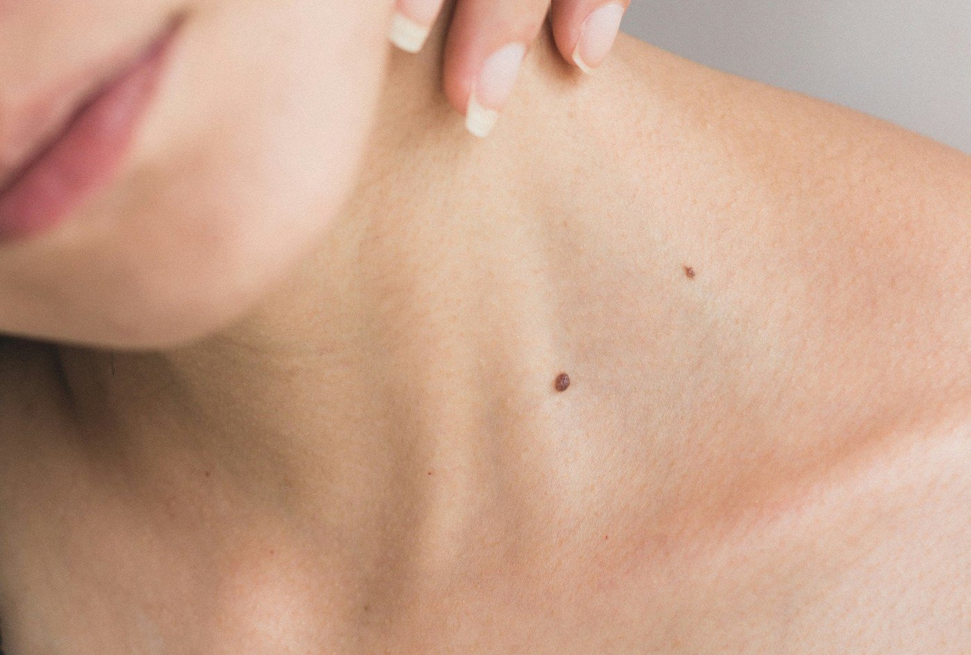 Close-up of a neck with a small mole