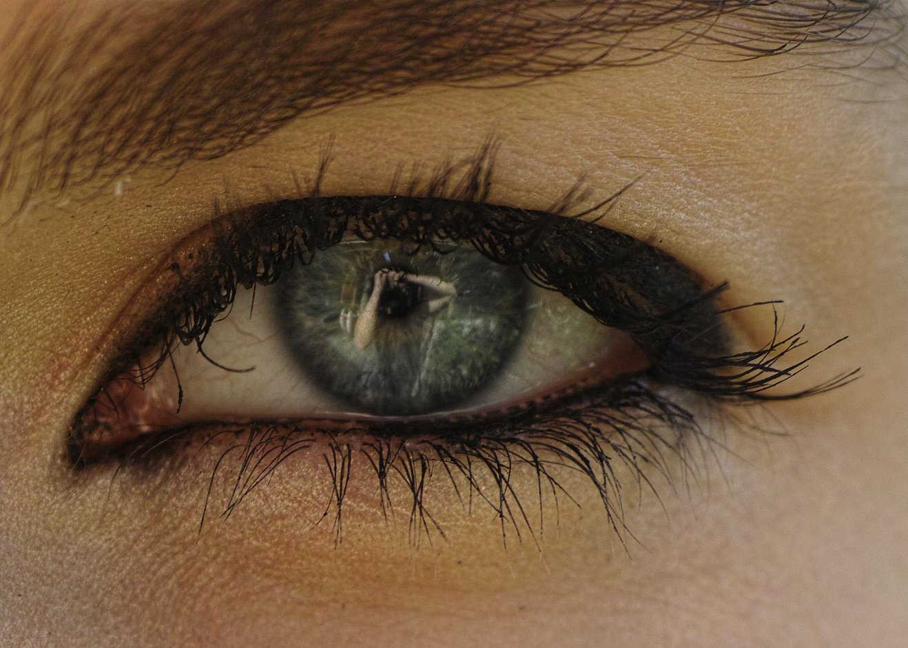 Close-up of one eye showing the white of the eye