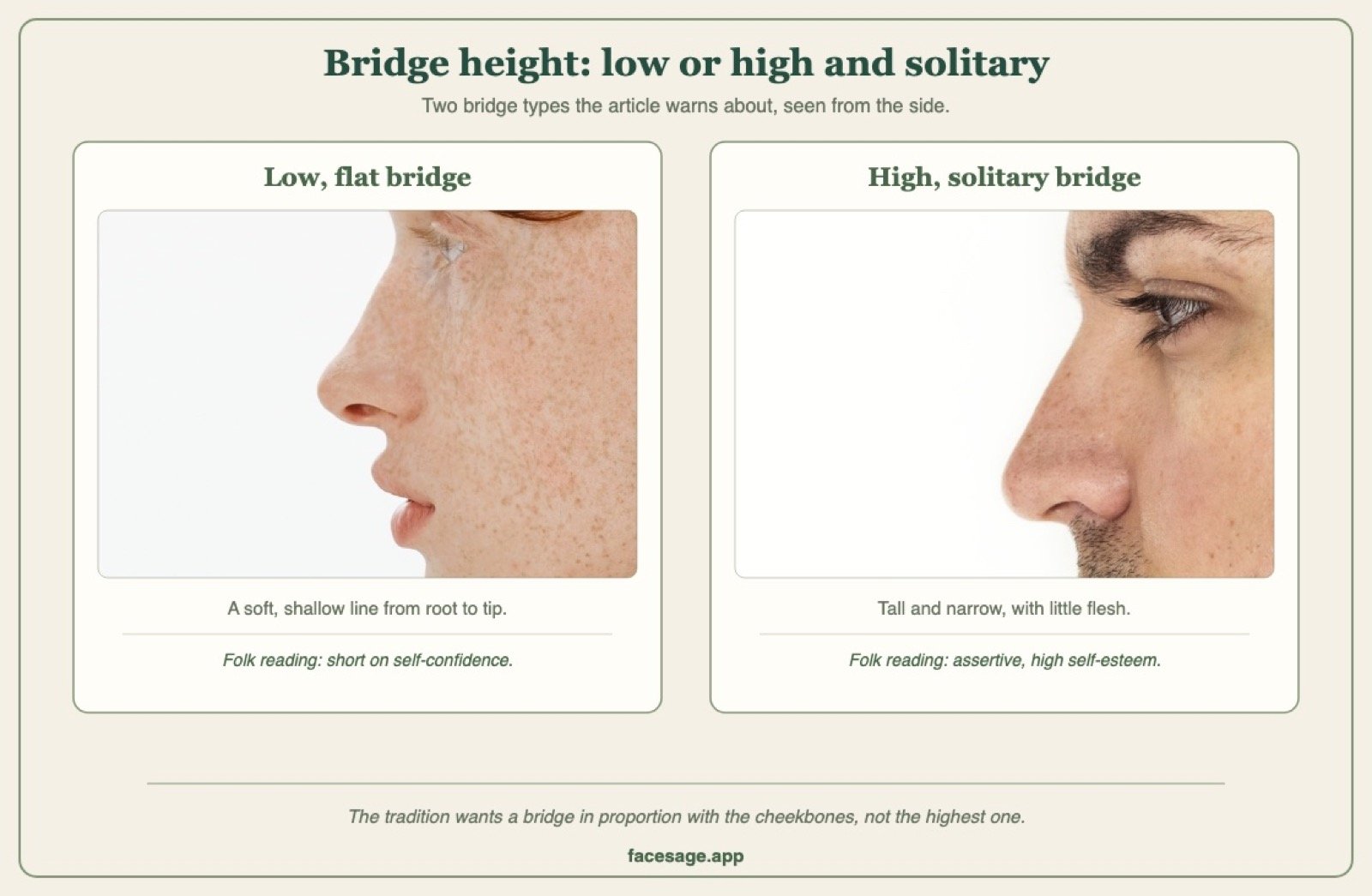 Two side-view nose close-ups comparing a low, soft bridge with a high, narrow bridge
