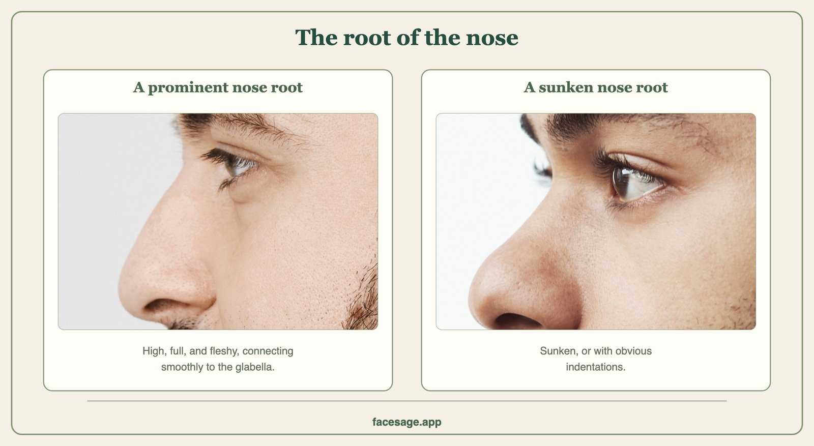 Two side-profile close-ups comparing a high nose root that flows into the brow with a nose root that dips inward
