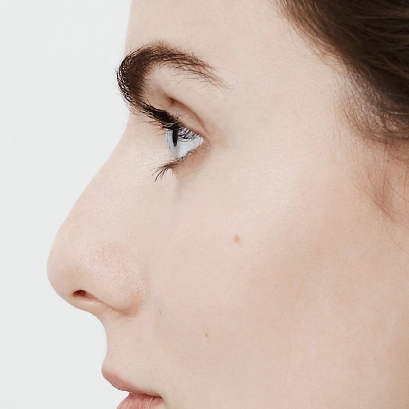 Side-profile close-up of a straight nose bridge