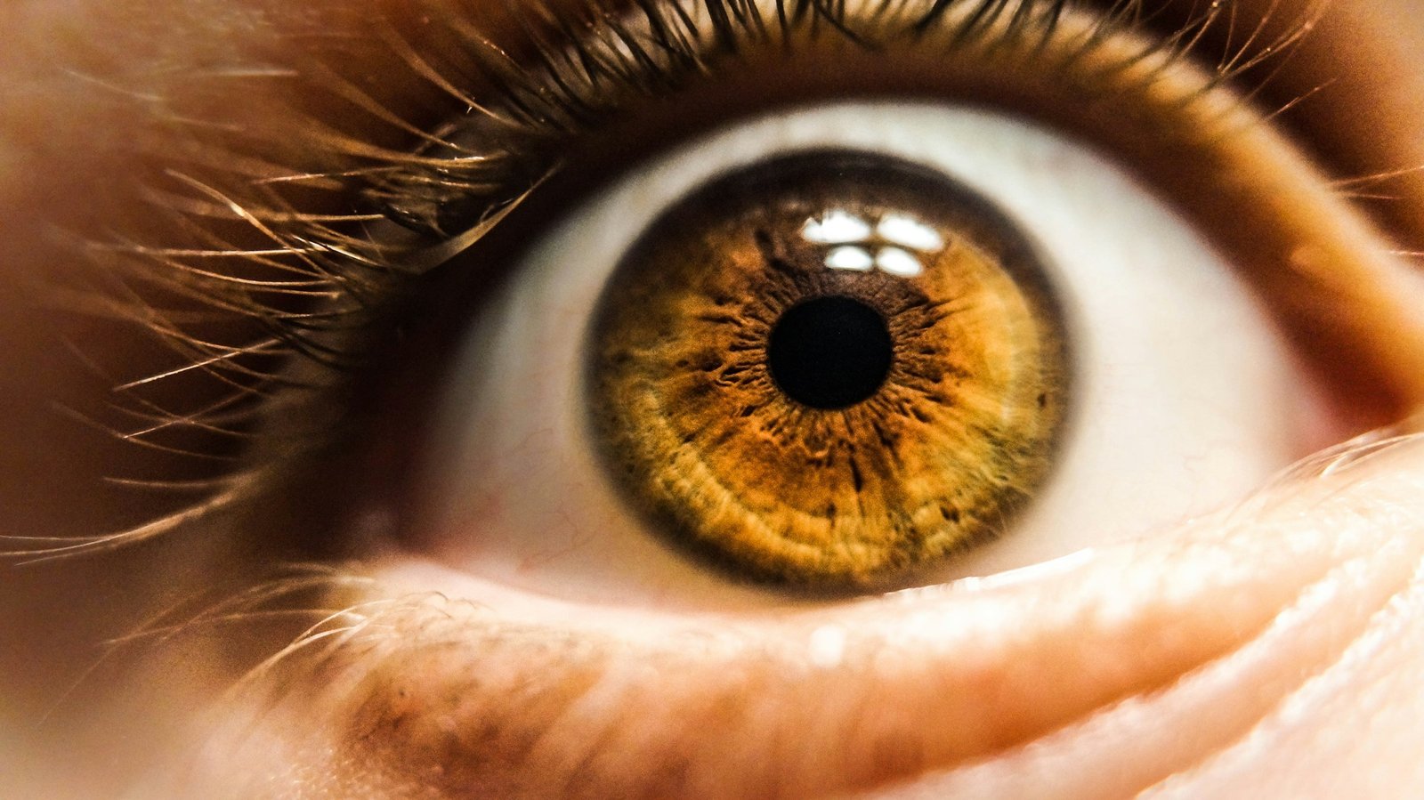 Close-up of a wide-open eye with white showing above the iris