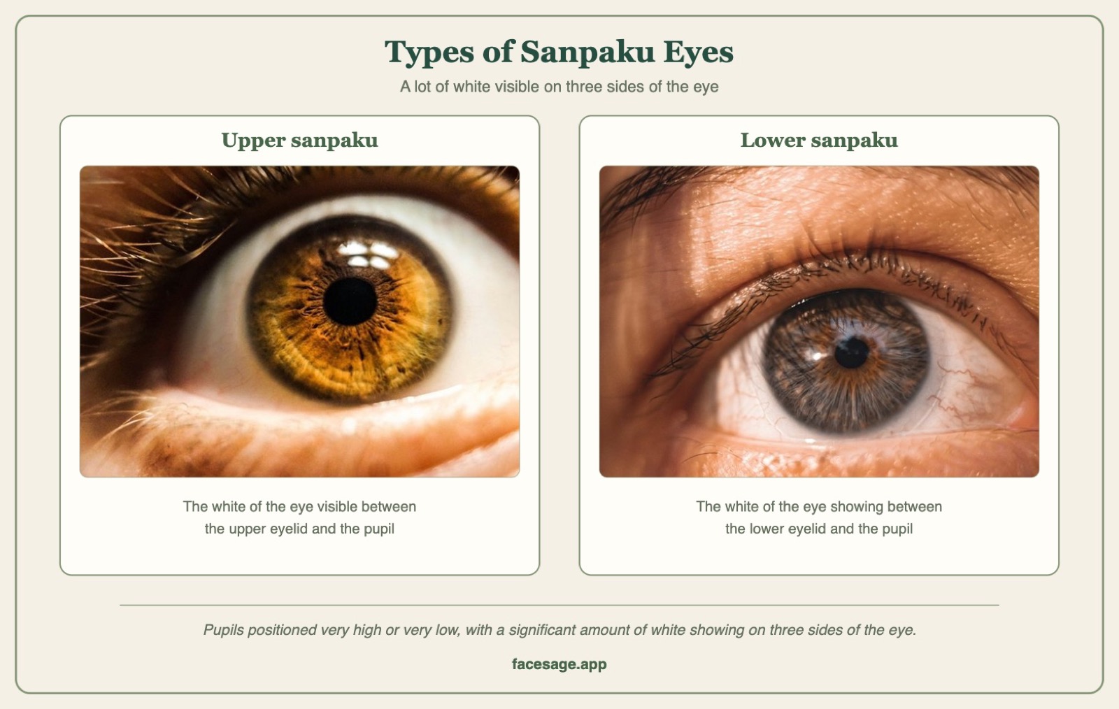Two single-eye close-ups labelled upper sanpaku and lower sanpaku