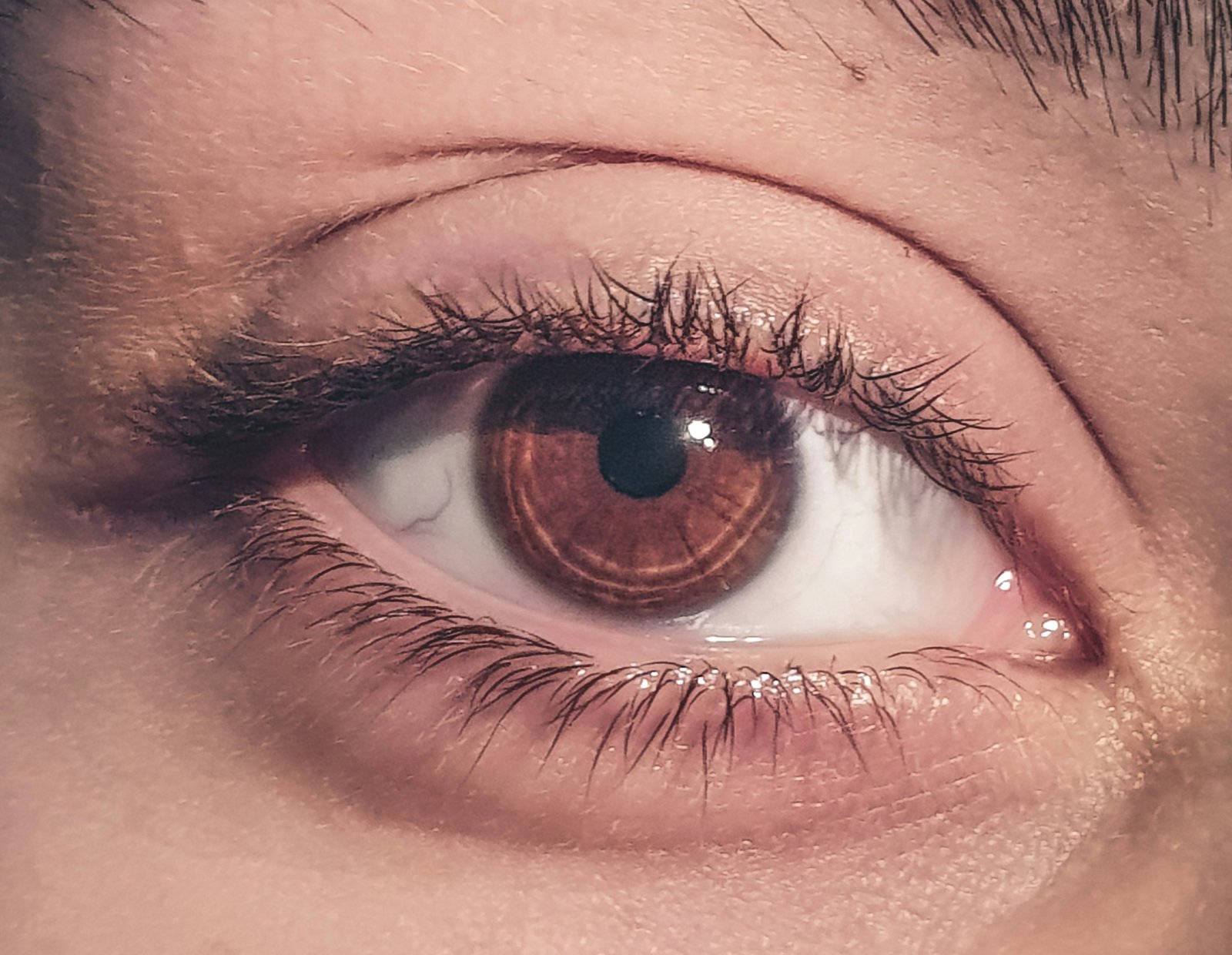Close-up of one brown eye with white showing below the iris