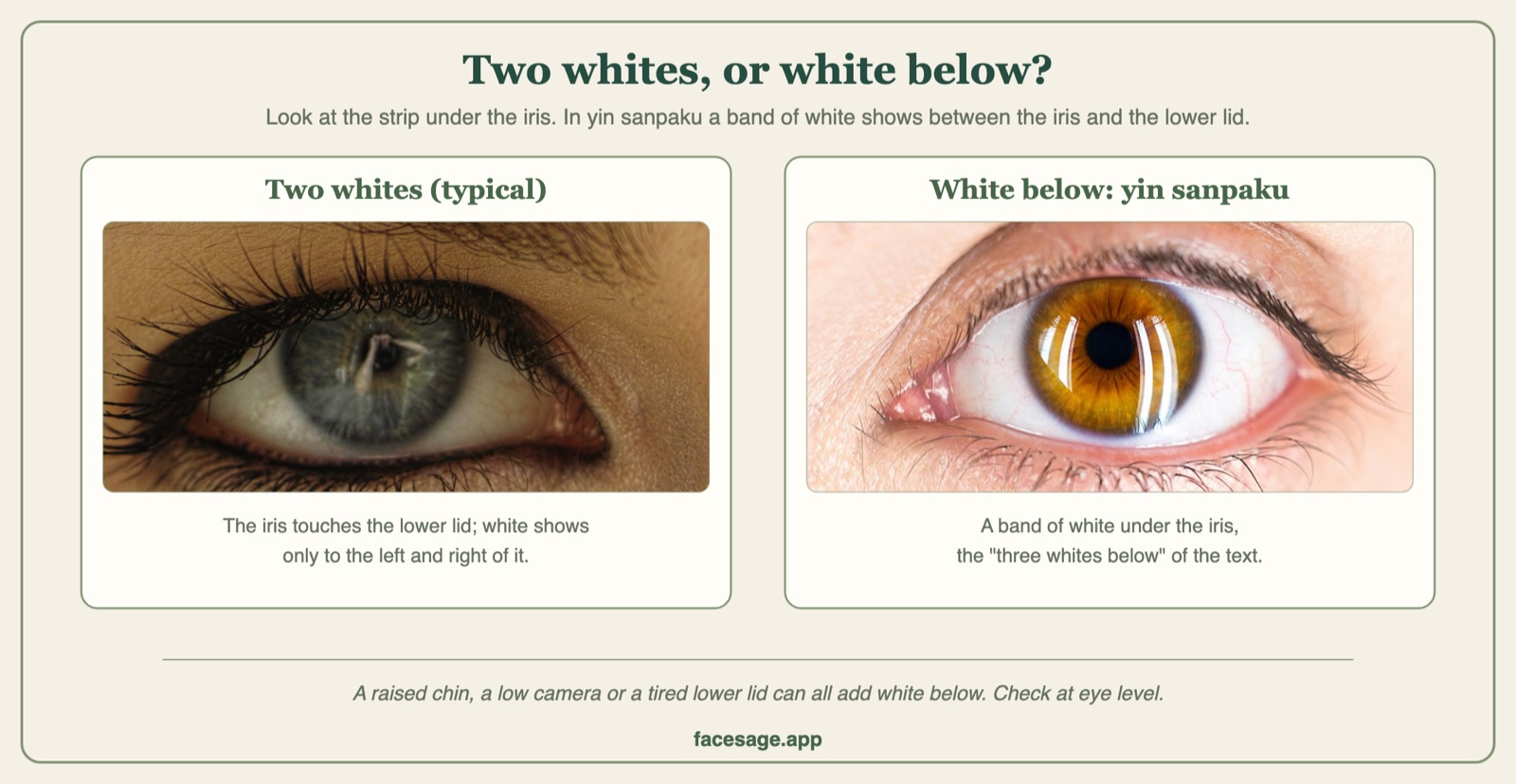 Two real eye close-ups: an iris touching the lower lid, and an iris with white showing below it