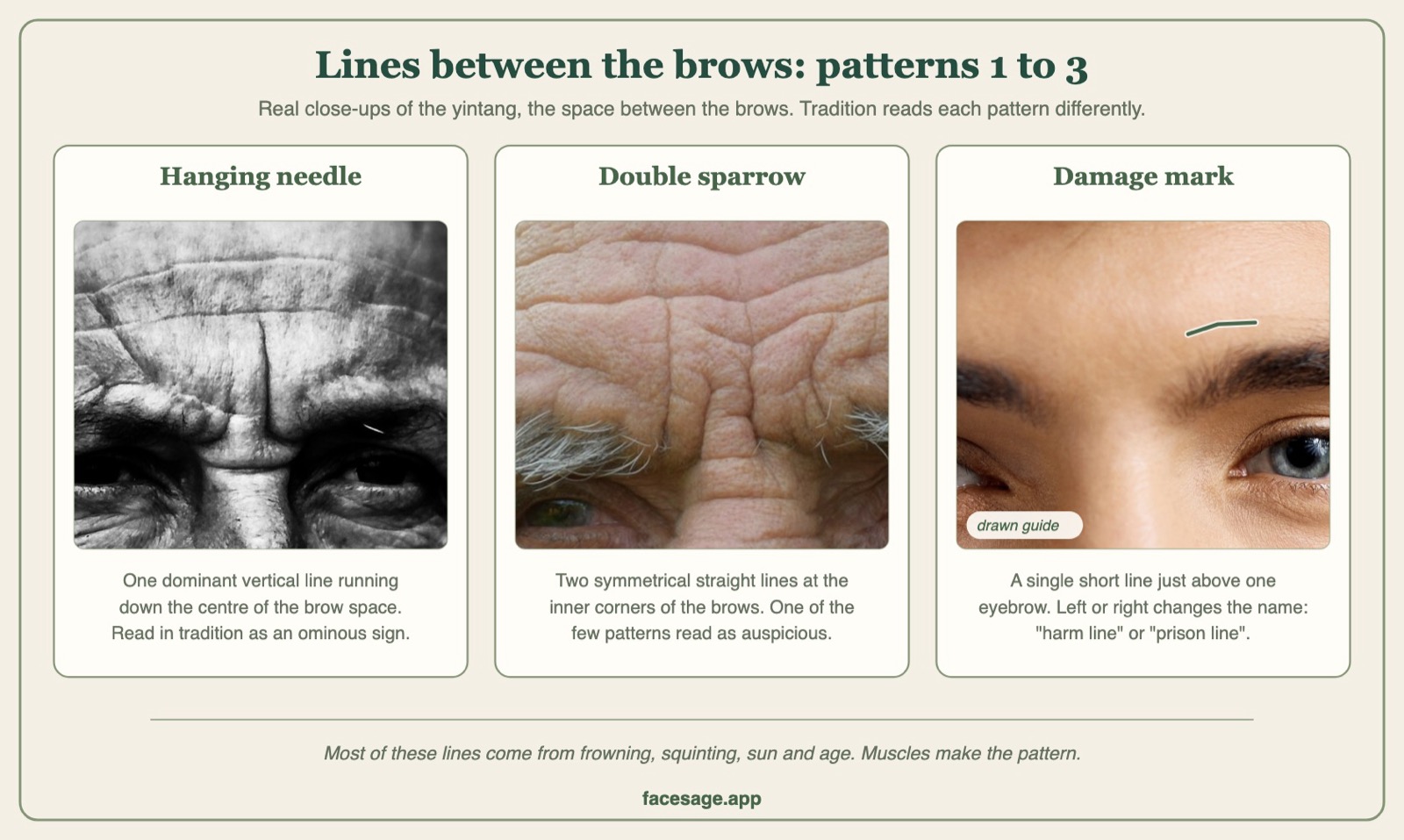 Close-ups of the space between the brows showing a hanging needle line, double sparrow lines and a damage mark