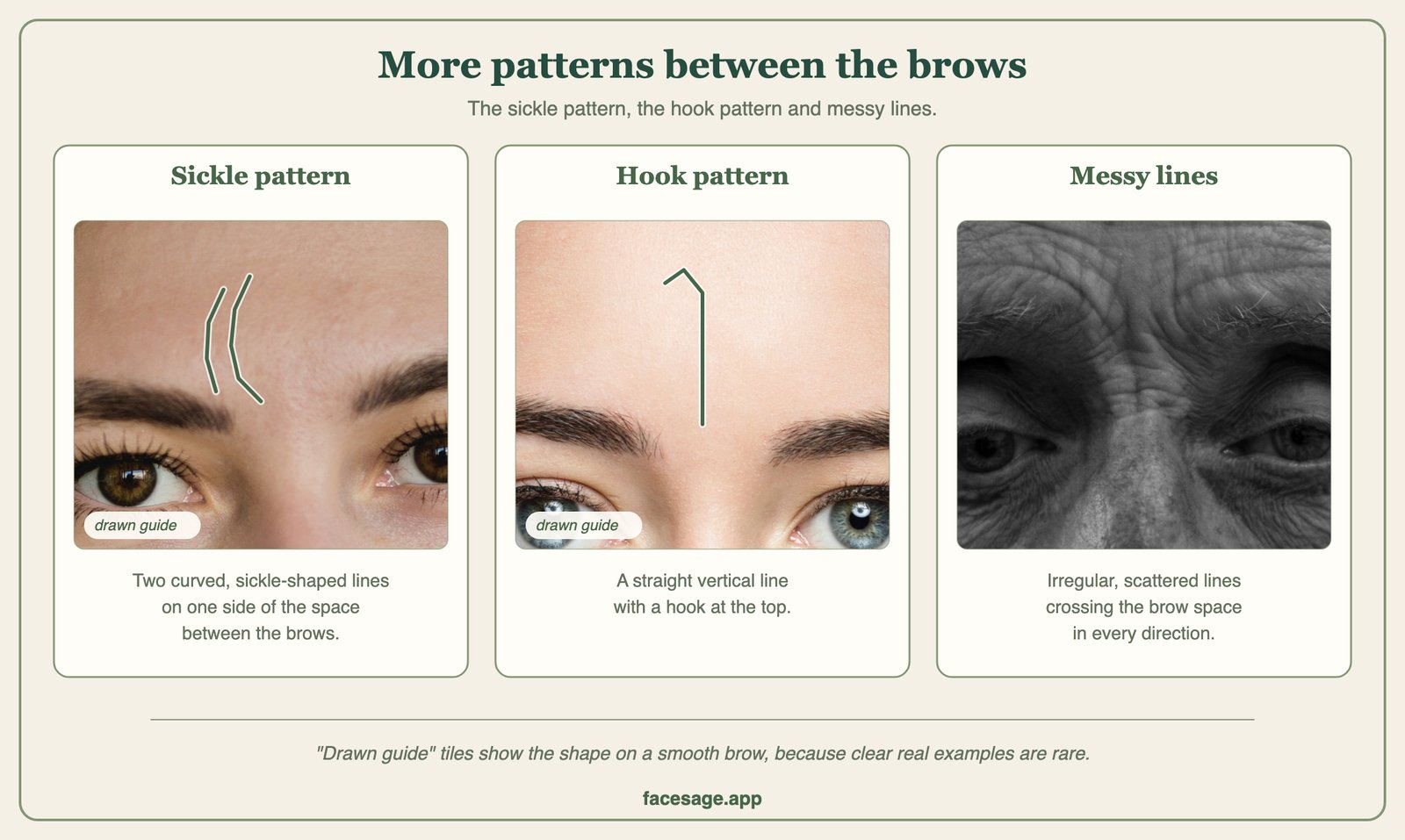 Brow close-ups showing sickle-shaped lines, a hooked vertical line and messy scattered lines
