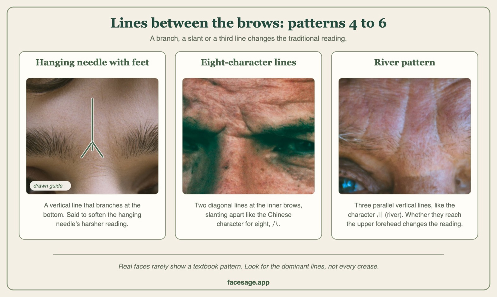 Close-ups between the brows showing a branching vertical line, two slanting lines and three parallel vertical lines
